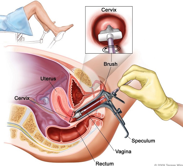 ginecologia clinica